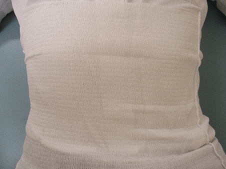  「まもりたい」でストーマ装具とガーゼ固定