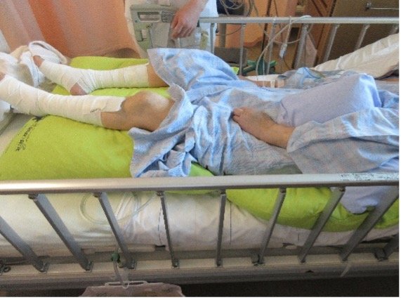 バナナフィットで背上げ姿勢を保持