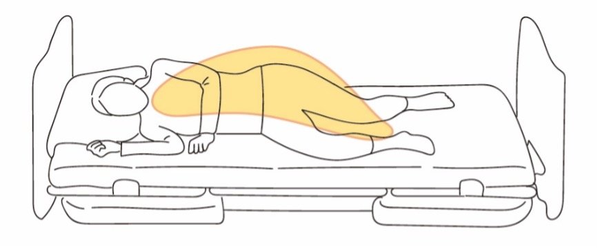 「バナナフィット」導入後