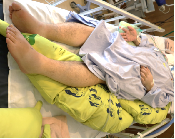 小さな体位変換前